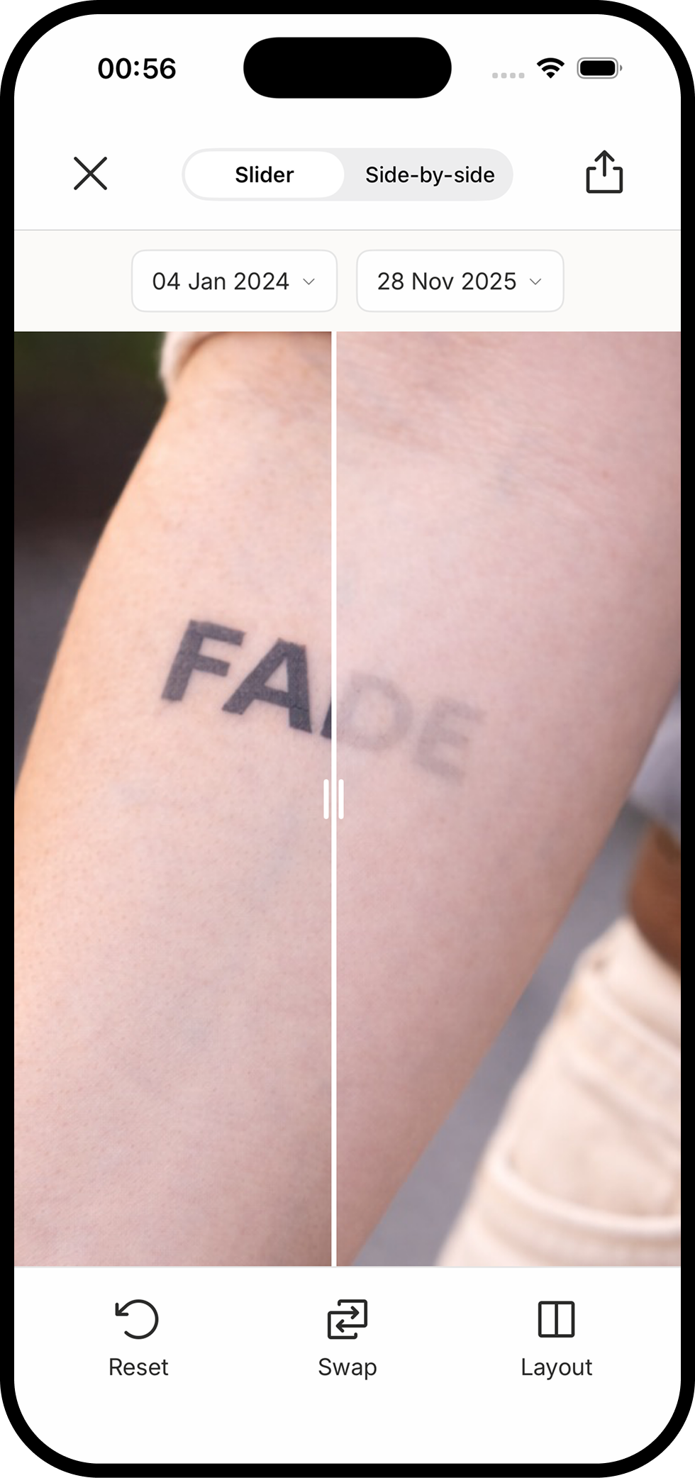 Before and after comparison slider